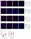 ALK1-mediated lipoprotein uptake requires APOB100.