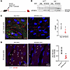 Treatment with APOB18-AAV inhibits aortic EC chylomicron uptake in vivo.