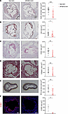 Treatment with APOB18-AAV reduces atherosclerosis.