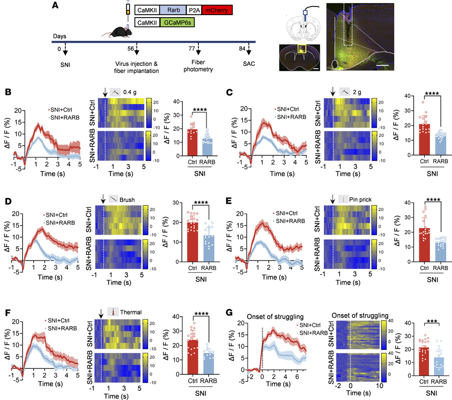 RARB overexpression in ACC alleviates neuronal hyperactivity induced by ...