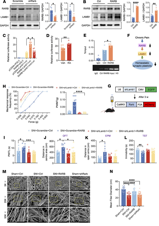 RARB regulates ECM remodeling via LAMB1 to modulate pain sensitivity and...