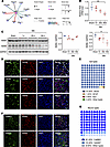 Peripheral neuropathy decreases RARB expression in the ACC.