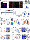 RARB knockdown in ACC induces pain hypersensitivity and anxiodepression.