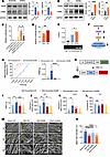 RARB regulates ECM remodeling via LAMB1 to modulate pain sensitivity and an
