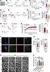RA alleviates neuronal overexcitation by regulating ECM microstructure thro