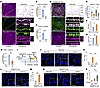 ANGPT2 and TIE2 differentially interact with active and inactive β1-integri