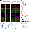 Regulation of phosphorylated TIE2 and β1-integrin in cell junctions in Itgb