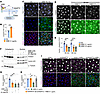 Inactive β1-integrin facilitates ANGPT2/TIE2/FOXO1 signaling in LECs.