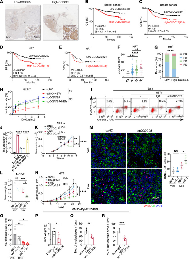 NETs promote therapeutic resistance of breast cancer via CCDC25.
(A) Rep...