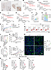 NETs promote therapeutic resistance of breast cancer via CCDC25.