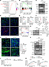 NET-CCDC25 interaction promotes tumor cell chemoresistance via STAT3 activa
