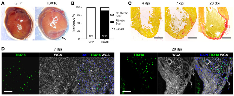 AAV-mediated TBX18 overexpression induces cardiac fibrosis in mouse hear...