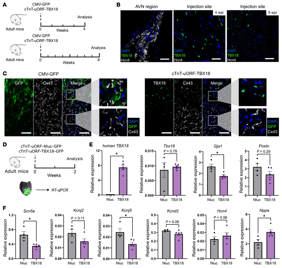 TBX18 expression at noncytotoxic level suppresses working myocardial gen...