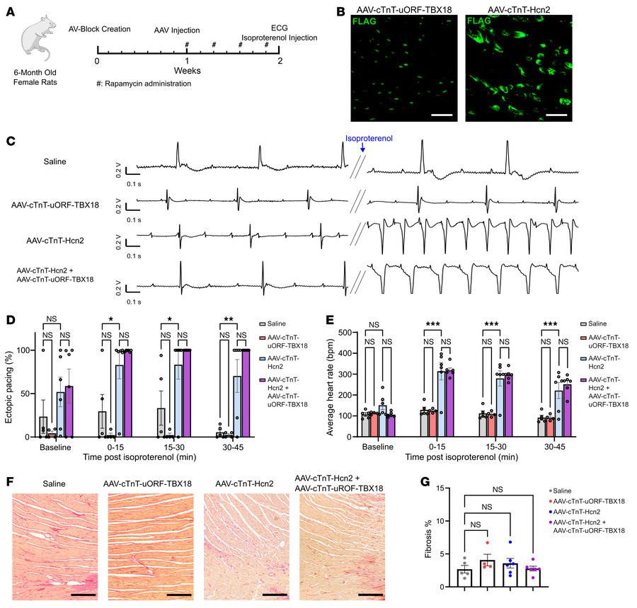 AAV-mediated expression of Hcn2 generates robust ectopic pacing in the p...