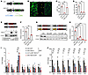 Dose-titrated expression cassette achieves low yet functional TBX18 express