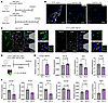 TBX18 expression at noncytotoxic level suppresses working myocardial genes