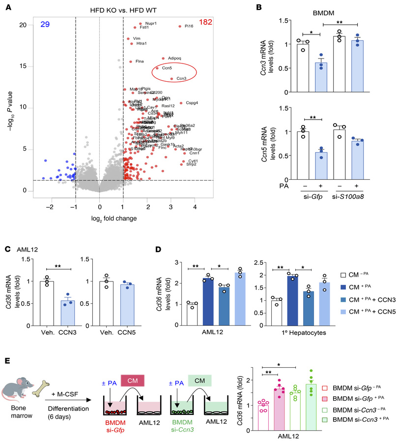 S100A8+ macrophages contribute to hepatocyte lipid accumulation by downr...