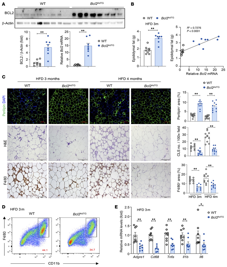Overexpression of the Bcl2 gene in adipocytes reduces high-fat diet–indu...