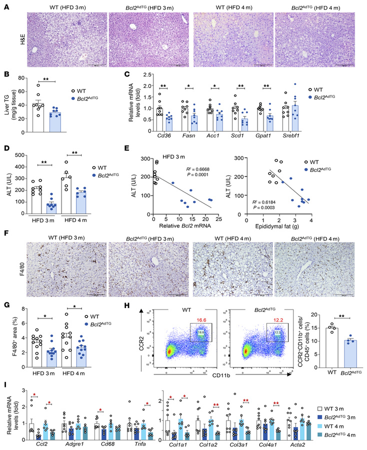 Overexpression of the Bcl2 gene in adipocytes reduces high-fat diet–indu...