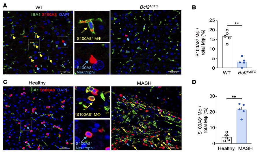 Hepatic S100A8+ macrophages are decreased in Bcl2AdTG mice and increased...