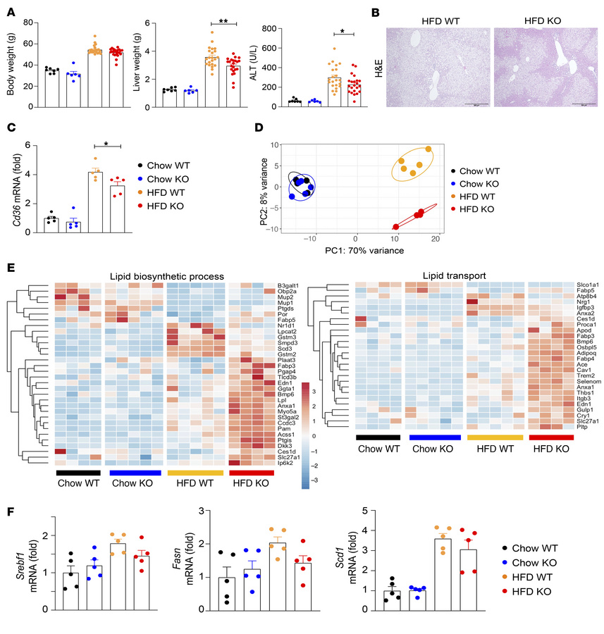 Macrophage-specific deletion of S100a8 attenuates steatosis development ...