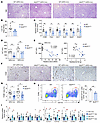Overexpression of the Bcl2 gene in adipocytes reduces high-fat diet–induced