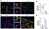 Hepatic S100A8+ macrophages are decreased in Bcl2AdTG mice and increased in