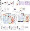 Macrophage-specific deletion of S100a8 attenuates steatosis development wit
