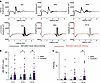 Selective pharmacologic inhibition of NaV1.4 with μ-conotoxin in muscles fr