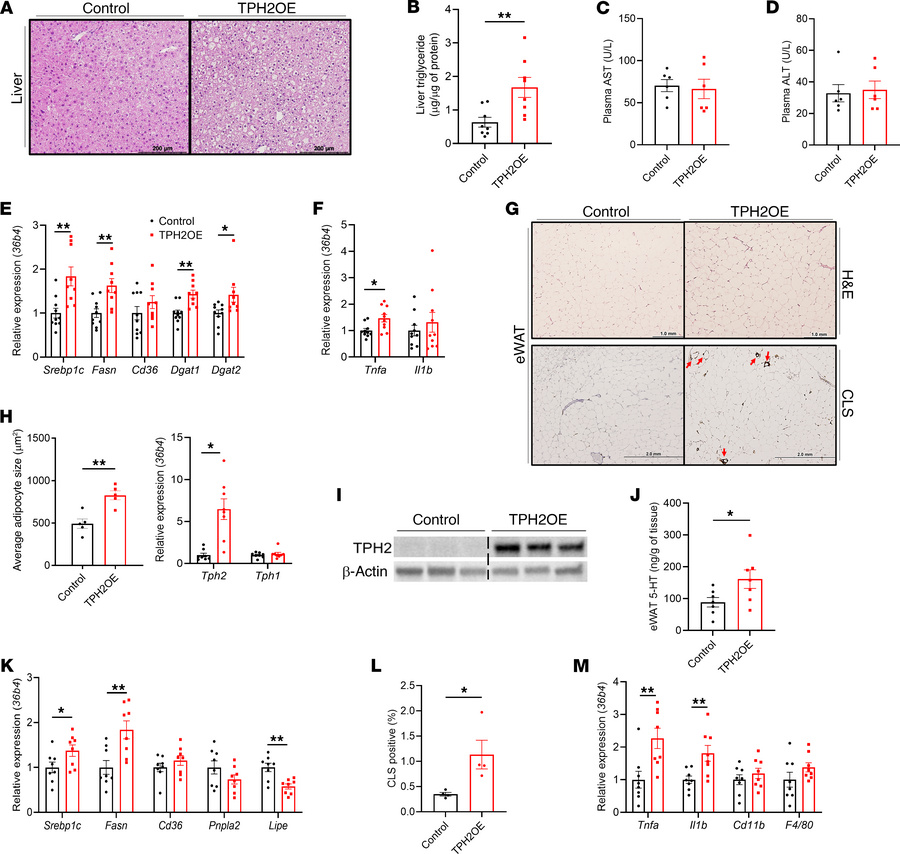 Adipocyte-specific TPH2 overexpression induces hepatic steatosis and adi...