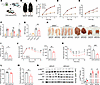 Mice with adipocyte-specific deficiency of TPH2 are not resistant to HFD-in