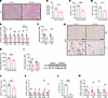 Genetic ablation of adipocyte TPH2 expression protects mice from HFD-induce