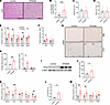 Adipocyte-specific TPH2 overexpression induces hepatic steatosis and adipoc