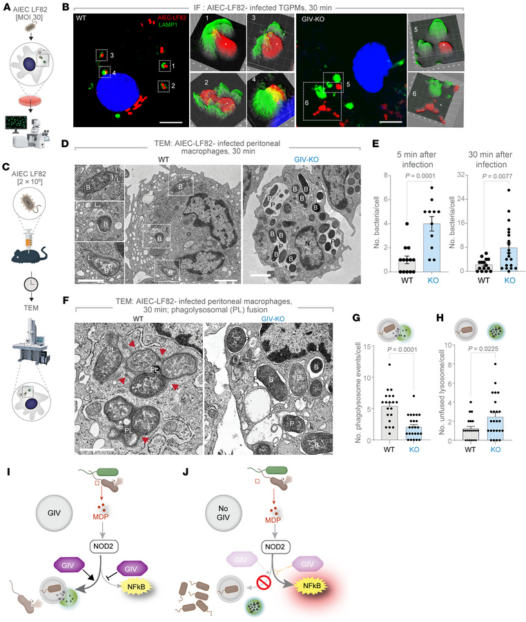 GIV is required for PL fusion and bacterial clearance.
(A and B) Workflo...