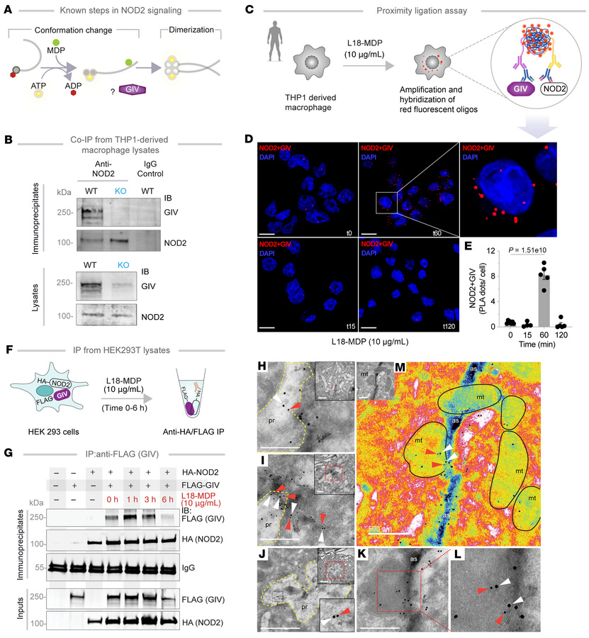 NOD2 and GIV colocalize and interact in cells.
(A) Schematic displays ke...