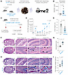 A mouse model of dysbiosis, impaired microbial clearance, patchy chronic tr