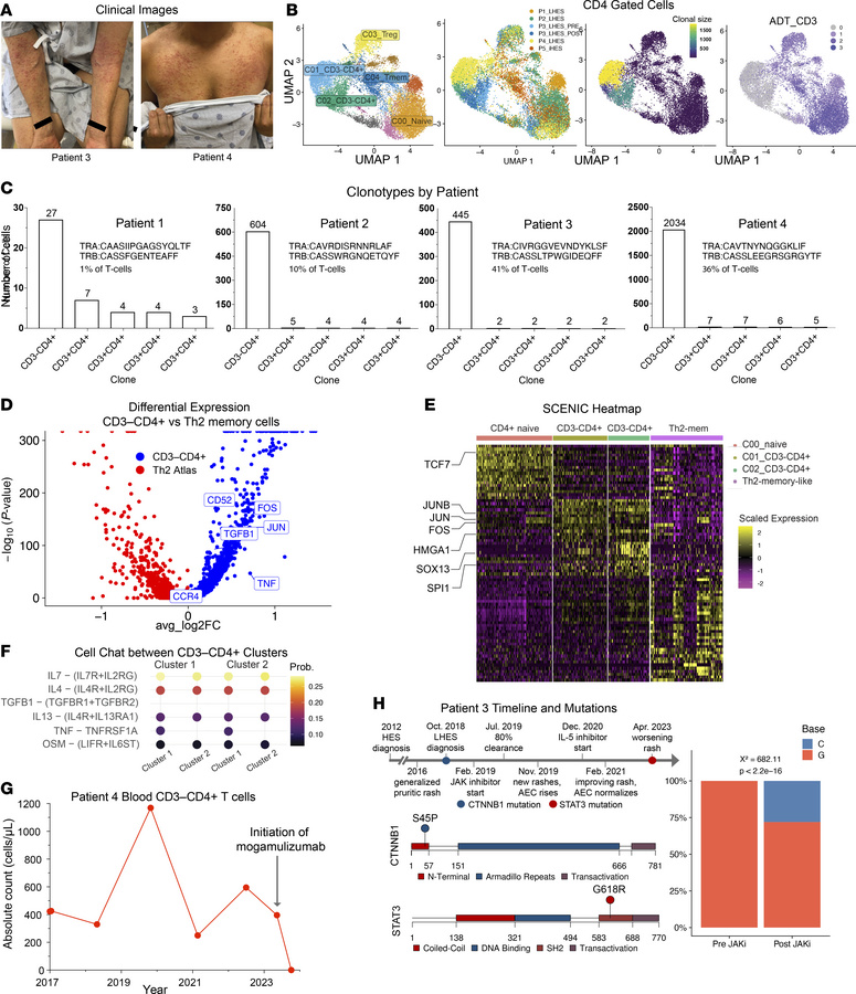 CD3–CD4+ lymphocytes are unique Th2-like cells and express targetable su...