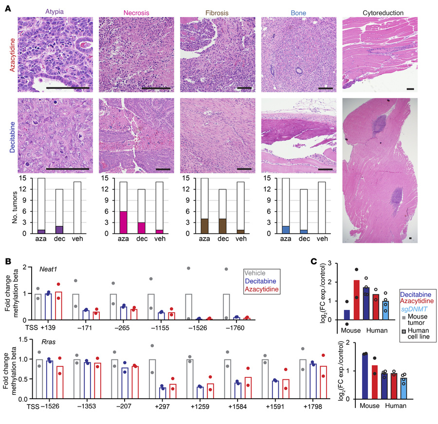Changes in methylation alter mesenchymal-related and tumor-suppressor ge...