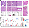 Changes in methylation alter mesenchymal-related and tumor-suppressor genes