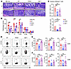PERK-deficient T cells have reduced ability to induce GVHD and differentiat