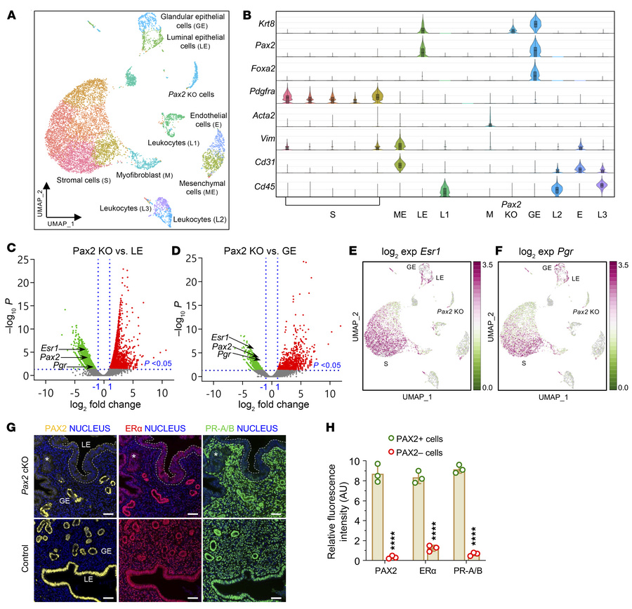 scRNA-seq reveals that inactivation of Pax2 loss correlates with reducti...