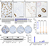 Emergence of PAX2-deficient clones in endometrial epithelium is age depende