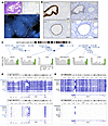 PAX2 protein loss is due to transcriptional silencing specific to PAX2 locu