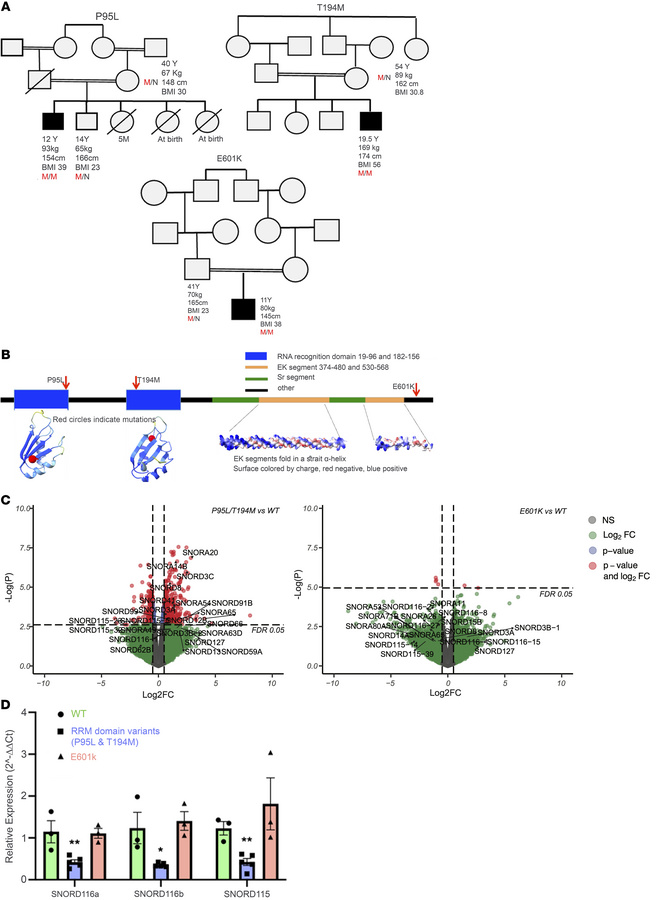 Rare biallelic SREK1 variants lead to downregulation of SNORD115 and SNO...