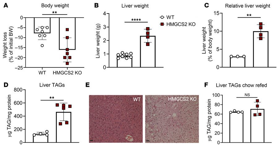 Ketogenic insufficiency induces hepatomegaly and steatosis.
Littermate c...