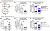 Ketogenic insufficiency impairs fat oxidation in perfused livers.