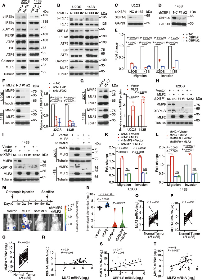 MLF2 promotes lung metastasis of osteosarcoma by activating IRE1α/XBP1-S...