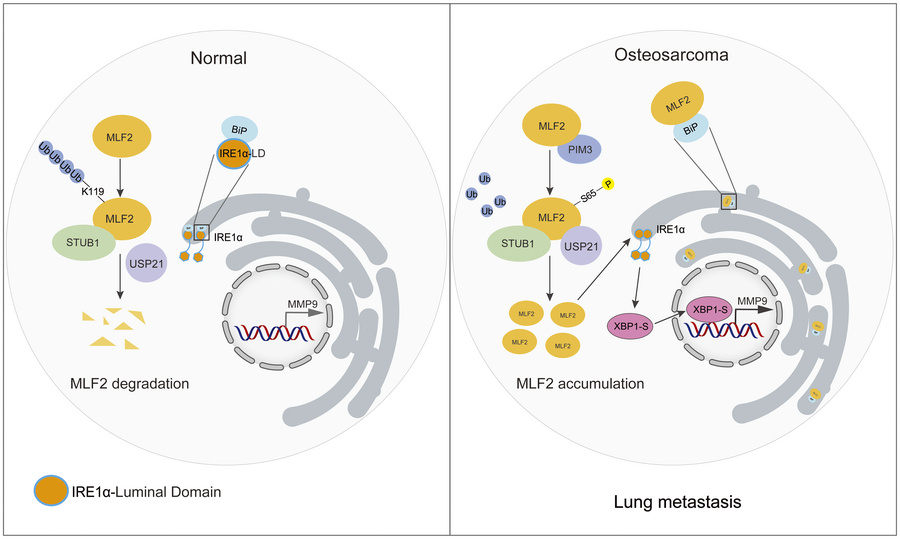 A proposed model for both function and regulation of MLF2 in osteosarcom...