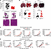 CD8+ T cells accelerate lung adenocarcinoma growth.