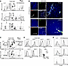 Phenotype of CD8+ T cells in murine melanoma compared with lung cancer.